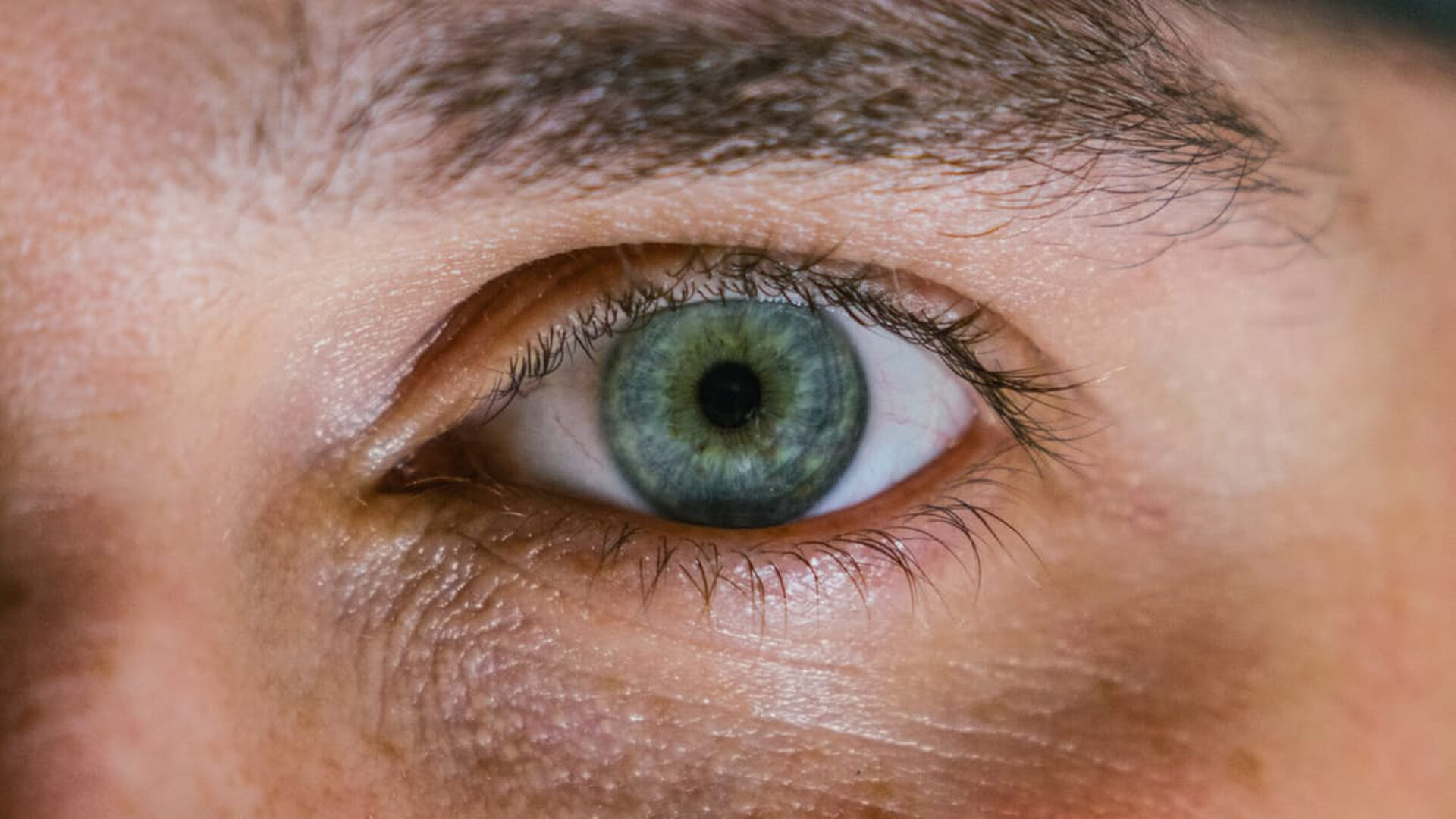 Myopie hypermétropie astigmatisme